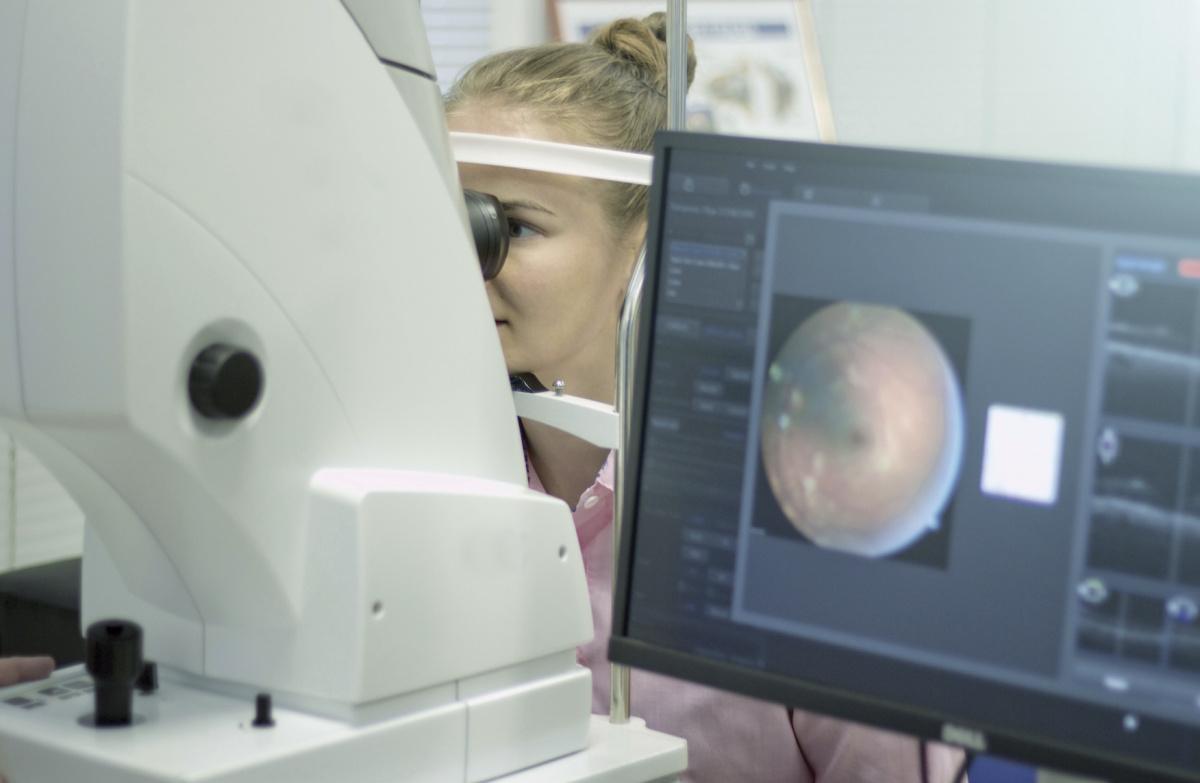 Miopía: una preocupación mundial Miopía: una preocupación mundial