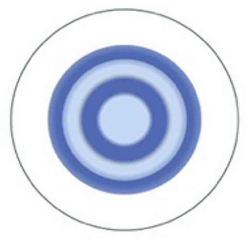 Miopía: una preocupación mundial