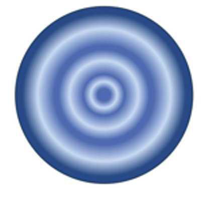 Miopía: una preocupación mundial Miopía: una preocupación mundial