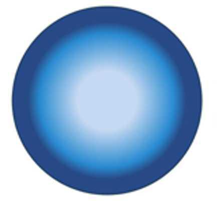 Miopía: una preocupación mundial Miopía: una preocupación mundial