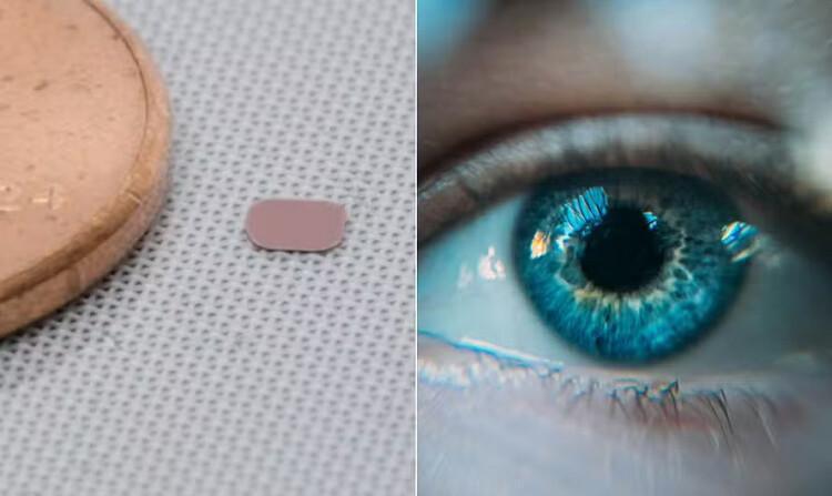 Implante de retina devolve leitura a pacientes com degeneração Implante de retina devolve leitura a pacientes com degeneração