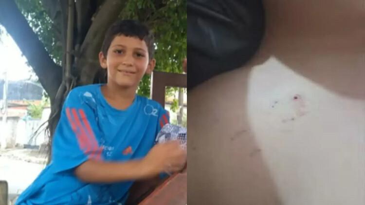 Itaguaí gasta R$ 25 milhões na saúde, mas não tem soro para salvar criança picada por cobra Itaguaí gasta R$ 25 milhões na saúde, mas não tem soro para salvar criança picada por cobra