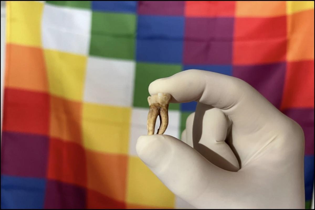 السر القديم: الجذور الأميركية للجذام قبل كولومبوس