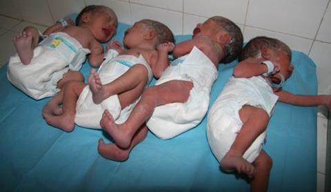 Naissance de quadruplés à l’hôpital Principal de Dakar
