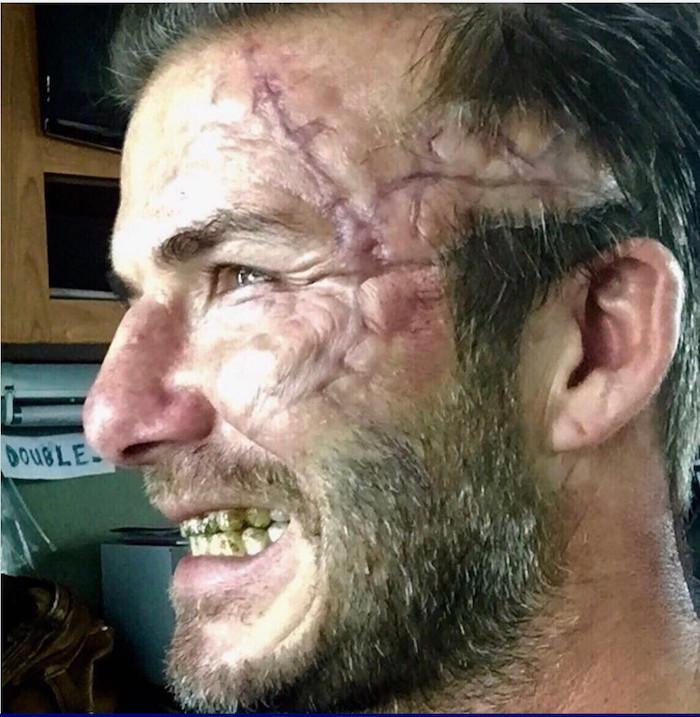 Qu'est-il arrivé à David Beckham? David Beckham a posté une photo de lui balafré sur Instagram.