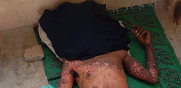 Algérie : Des Sénégalais “attaqués au cocktail molotov et au couteau”