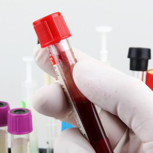 Analisi del sangue capillare