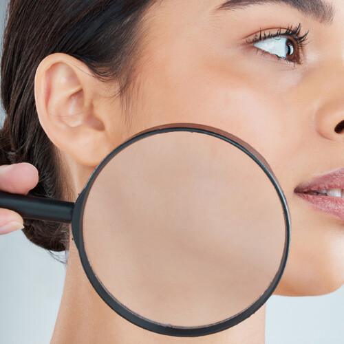 Analisi della pelle Analisi della pelle