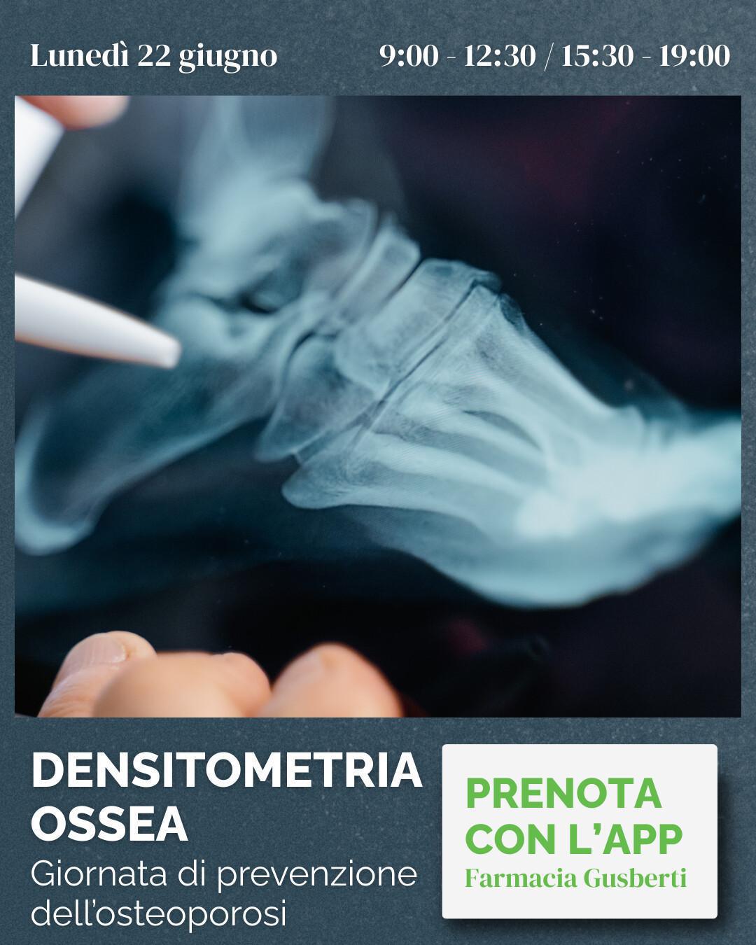 🦴 Densitometria ossea
