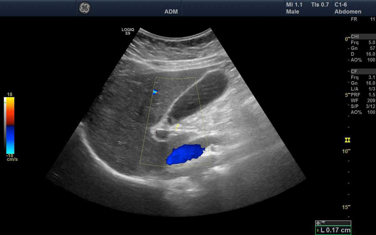 ECMU Abdominale – Introduction