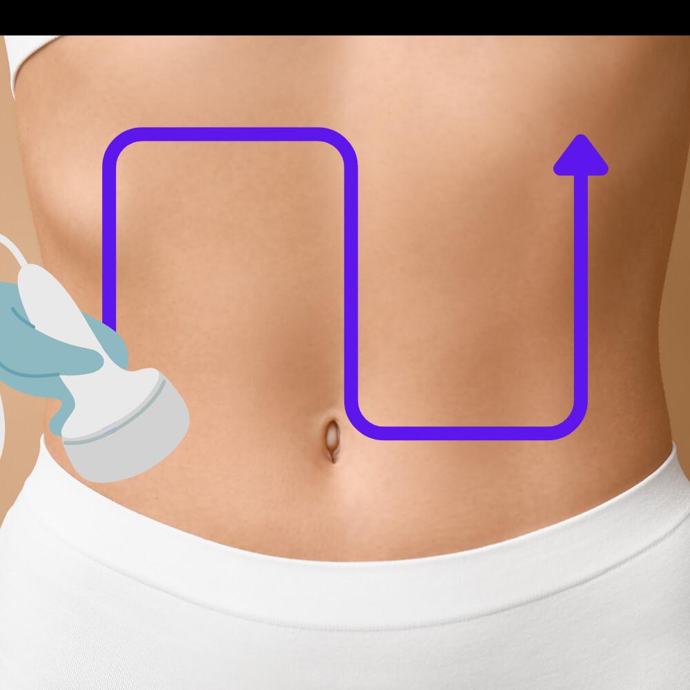 Occlusion Intestinale Occlusion Intestinale