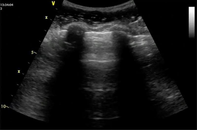 Aspects physiologiques Aspects physiologiques