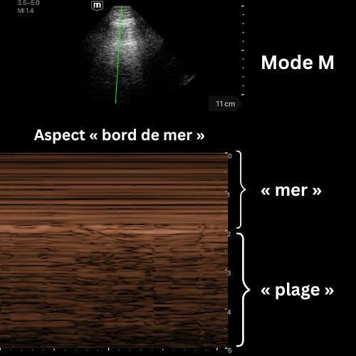Aspects physiologiques