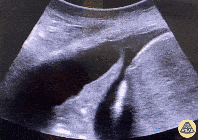 Aspects pathologiques