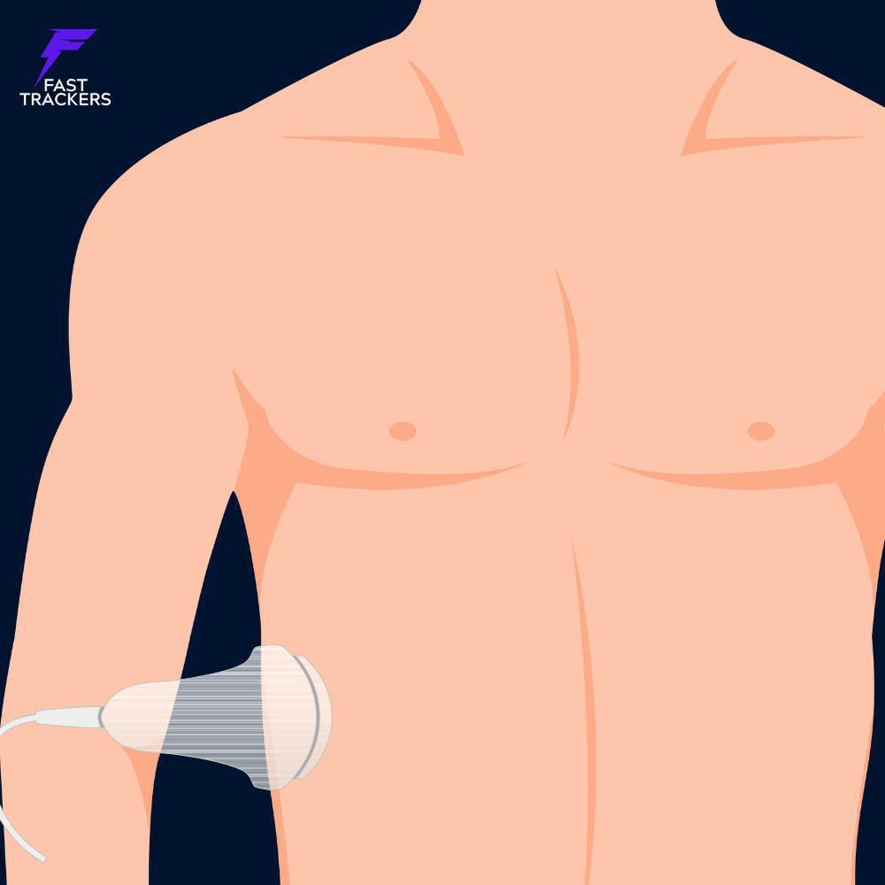 Vue hépatorénale (Morrison) Vue hépatorénale (Morrison)