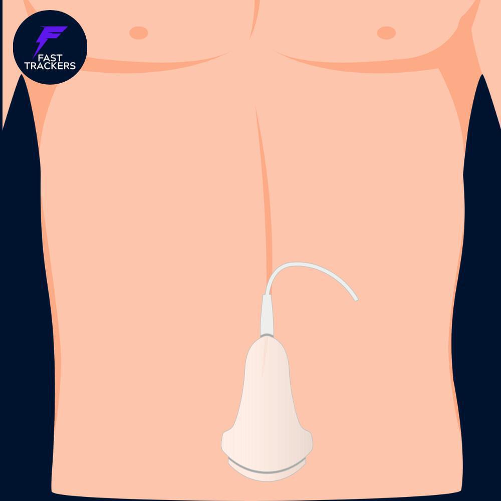 Vue pelvienne Vue pelvienne