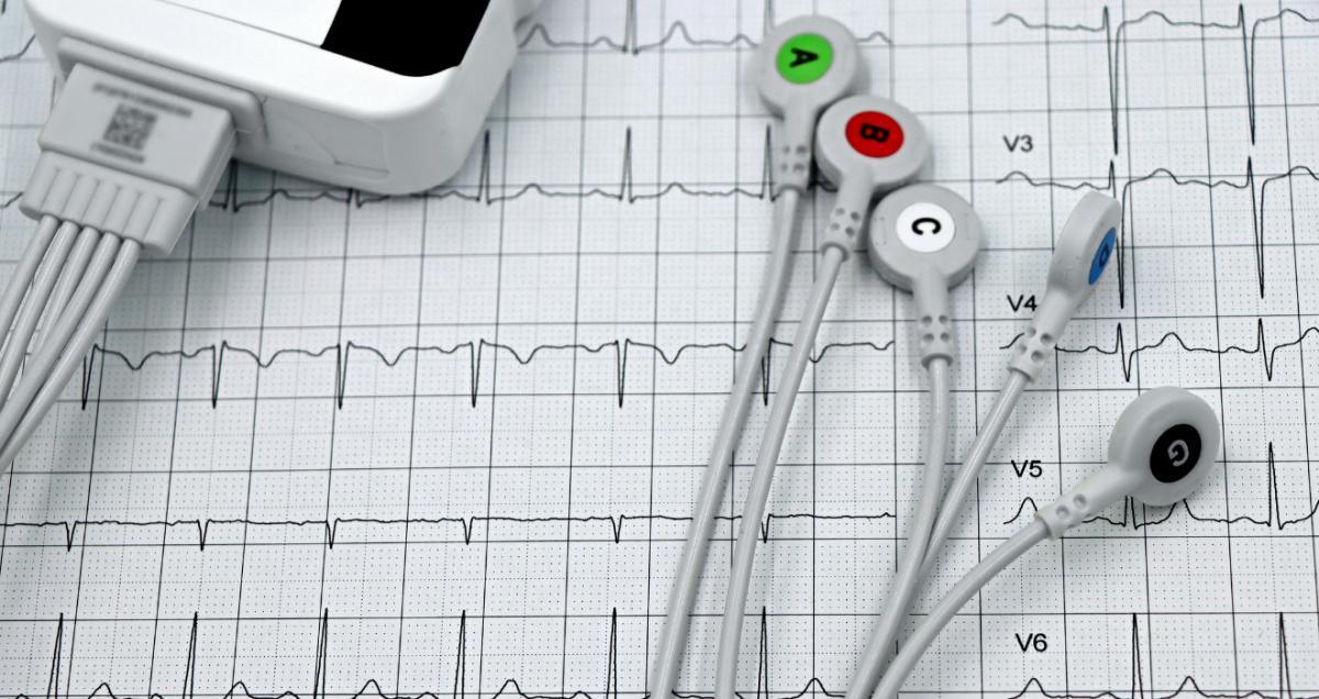 Holter ECG Holter ECG