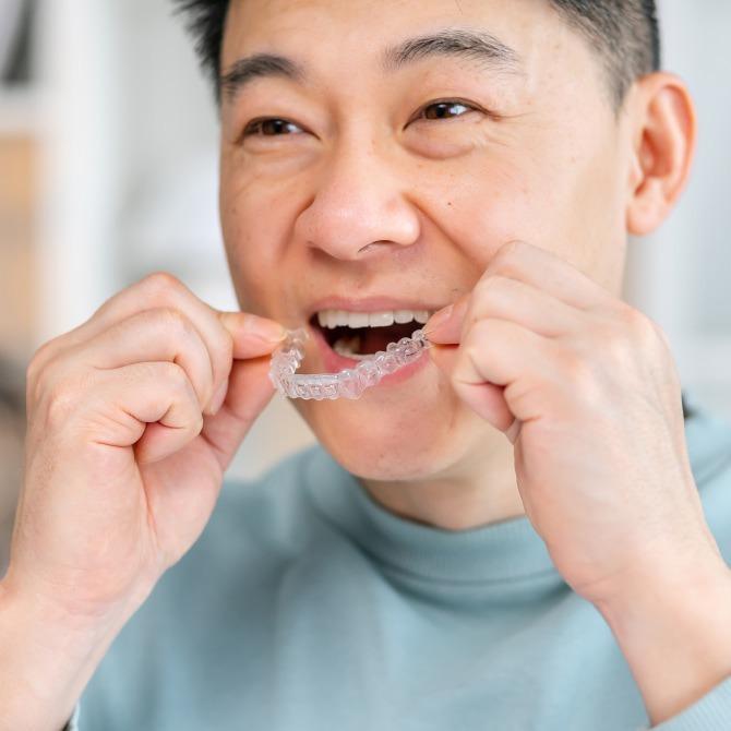 INVISALIGN®