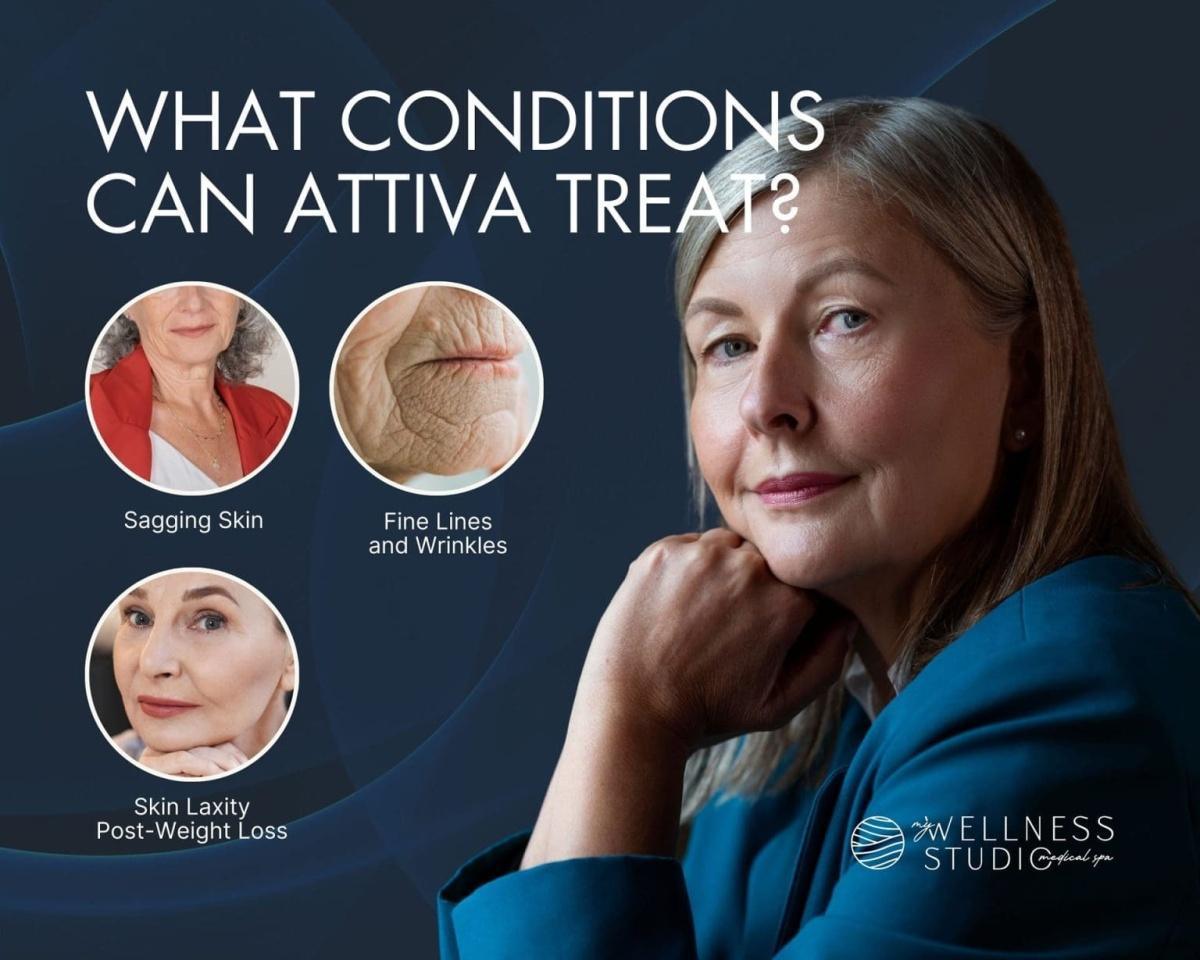 ATTIVA