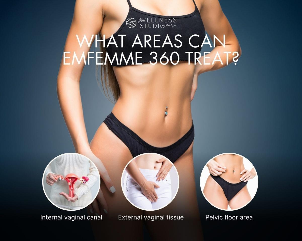 EMFEMME 360