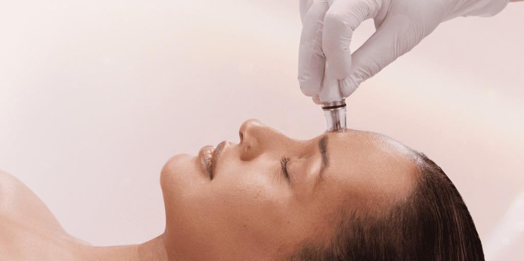 SKIN REJUVENATION SKIN REJUVENATION