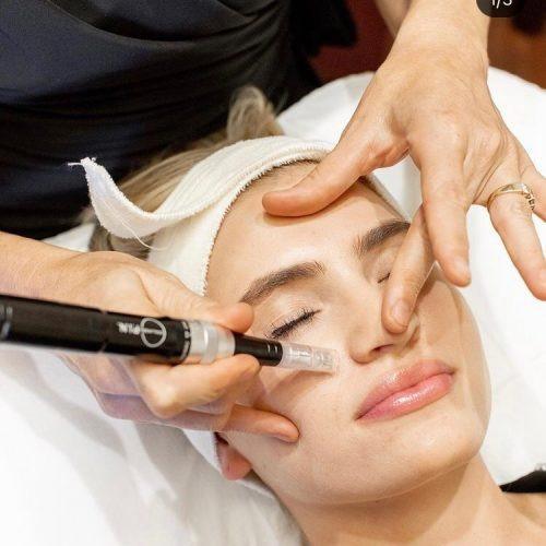 SKIN RESURFACING SKIN RESURFACING