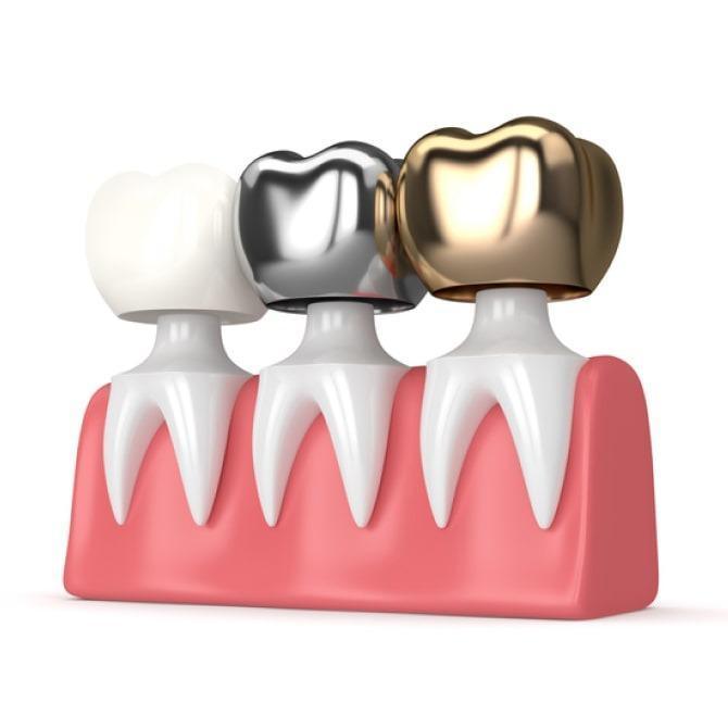 SAME-DAY CROWNS