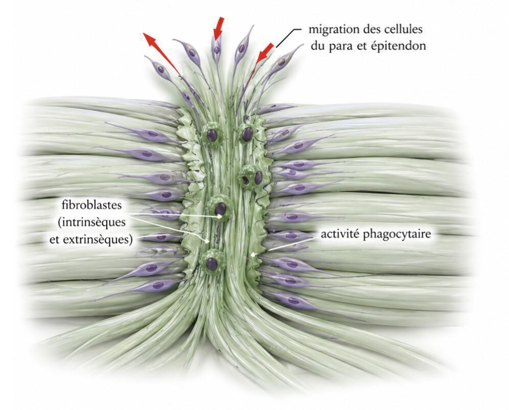Cicatrisation tendineuse, œdème et résistance au glissement des fléchisseurs Cicatrisation tendineuse, œdème et résistance au glissement des fléchisseurs