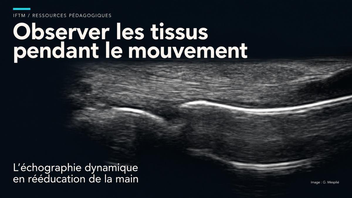 Échographie dynamique en rééducation de la main : de la question clinique au bénéfice fonctionnel