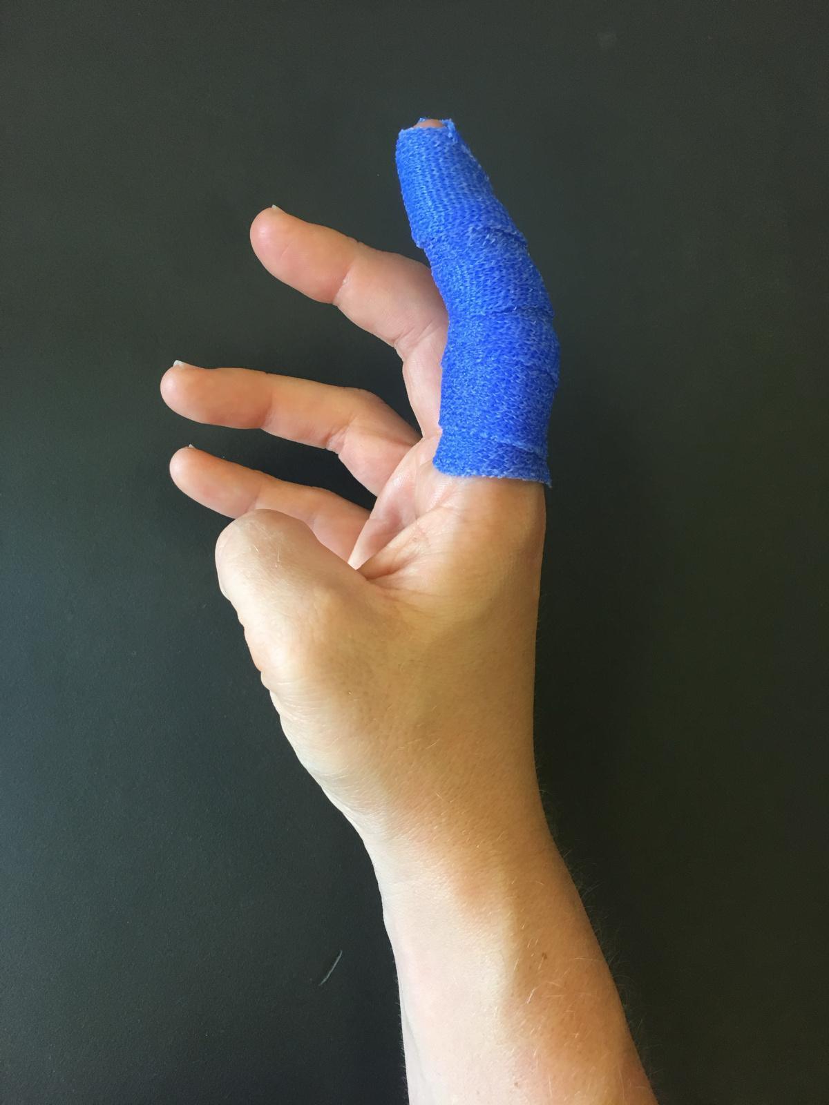 Orthèses de la main : raisonnement clinique et parcours de soins Orthèses de la main : raisonnement clinique et parcours de soins