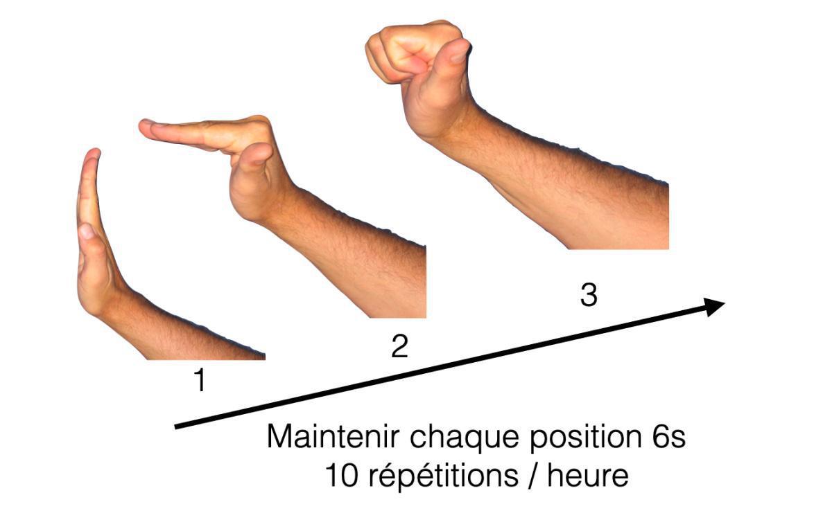 FICHE CONSEILS FRACTURES DE LA MAIN FICHE CONSEILS FRACTURES DE LA MAIN