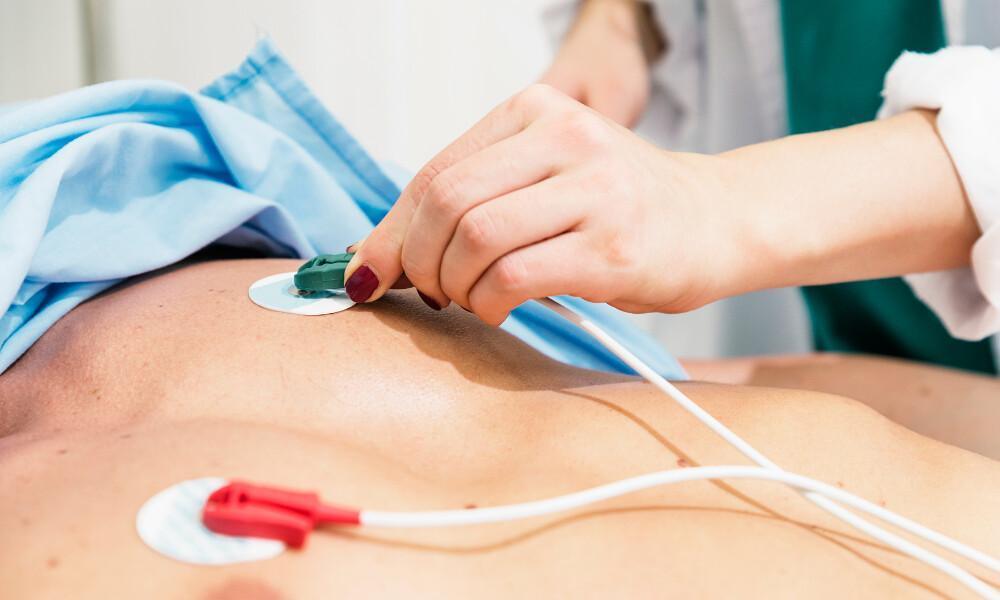 ECG