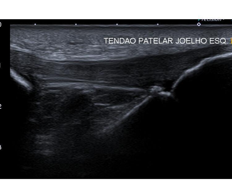 ULTRASSOM MUSCULOESQUELÉTICO ULTRASSOM MUSCULOESQUELÉTICO