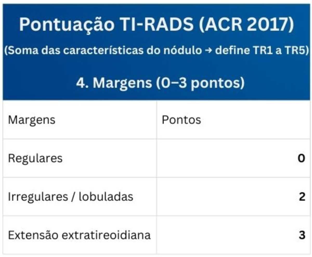 Tabelas em US da Tireoide e Reg. Cervical