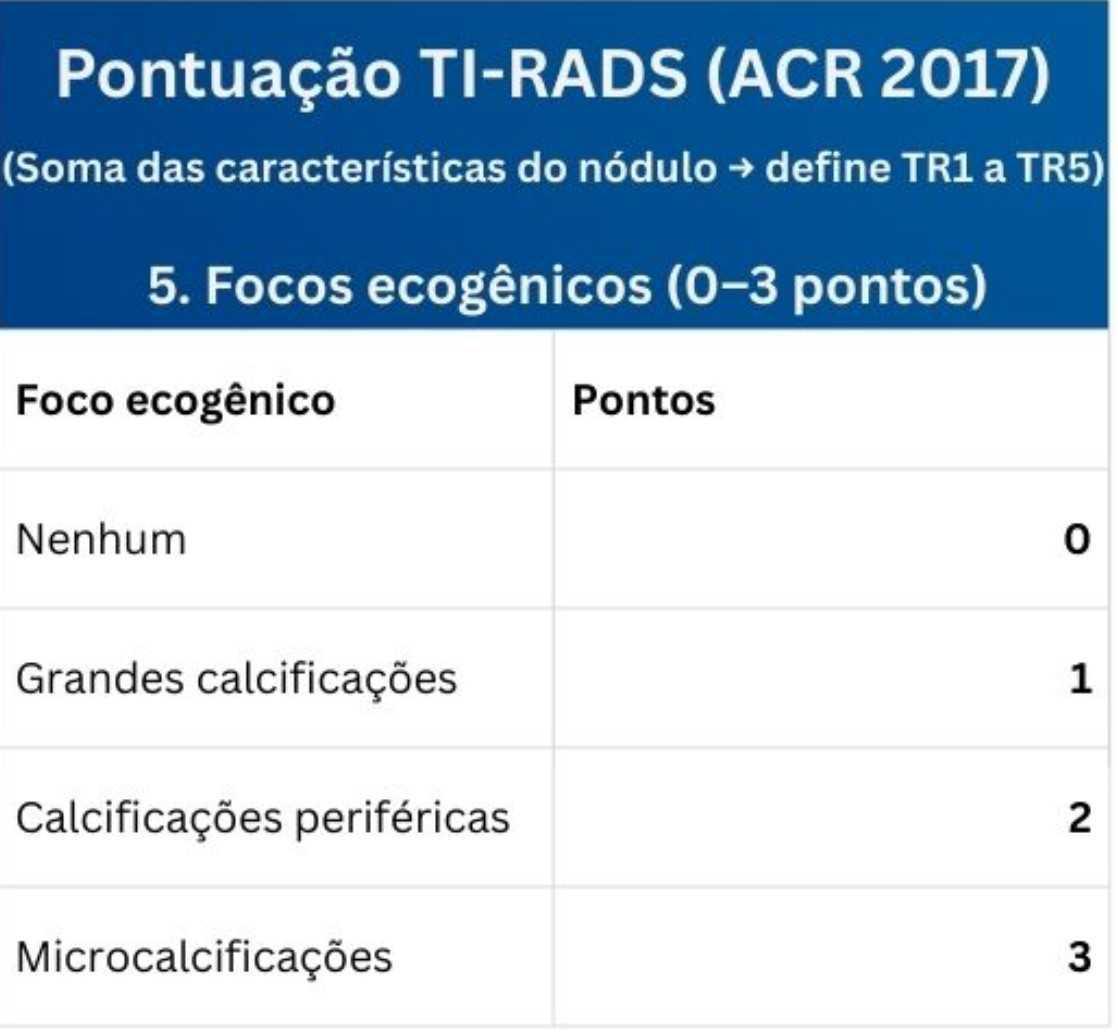 Tabelas em US da Tireoide e Reg. Cervical