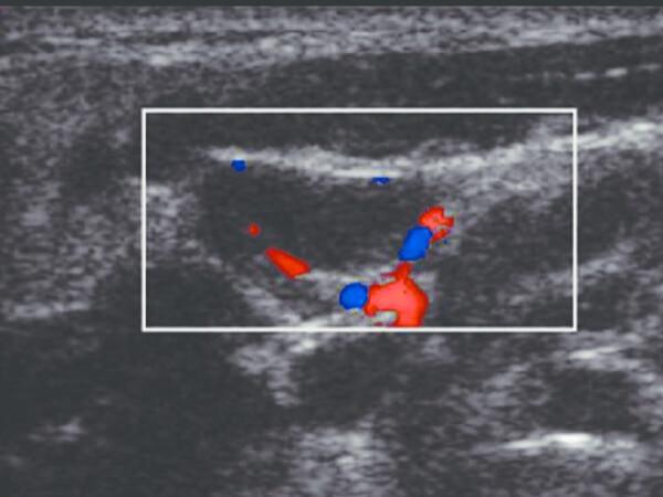 ULTRASSOM DA REGIÃO CERVICAL ULTRASSOM DA REGIÃO CERVICAL