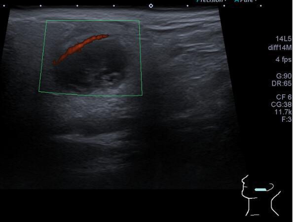 Biblioteca de imagens - Região cervical