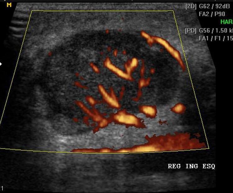 Biblioteca de imagens - Parede abdominal