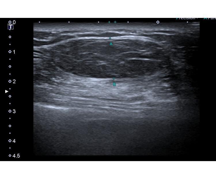 Biblioteca de imagens - Parede abdominal