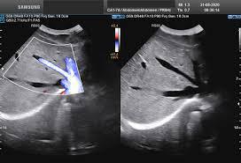 ECODOPPLER PORTAL ECODOPPLER PORTAL