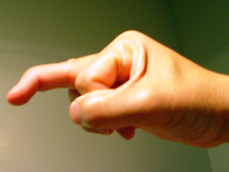 Atteinte de l’IPD (Mallet finger) Atteinte de l’IPD (Mallet finger)