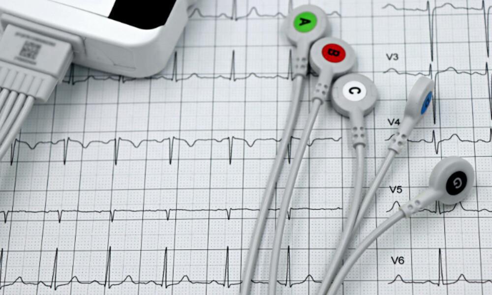 Holter cardiaco Holter cardiaco