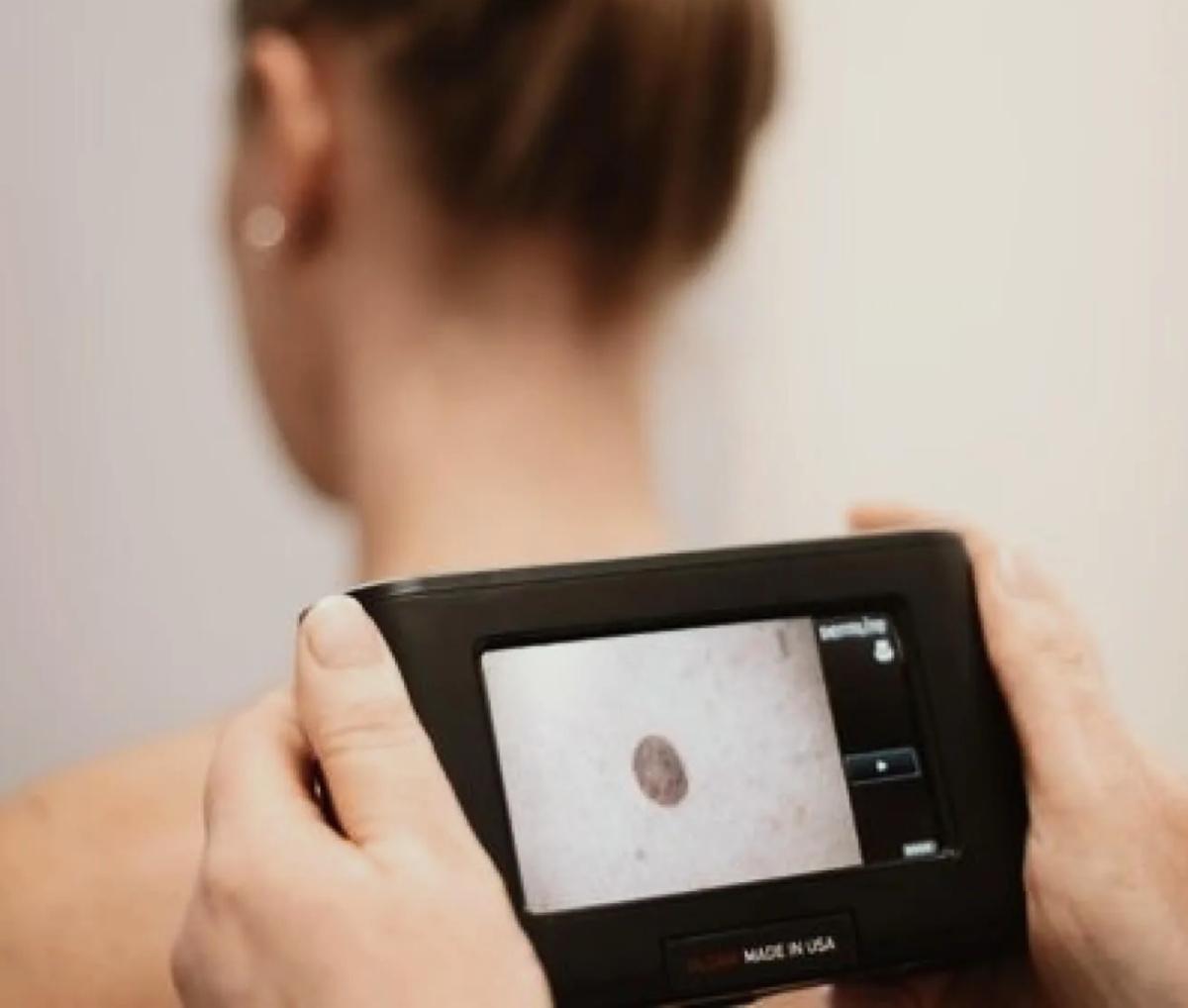 Teledermatologia
