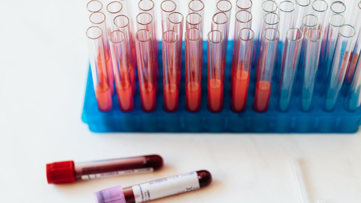 Autoanalisi del sangue Autoanalisi del sangue