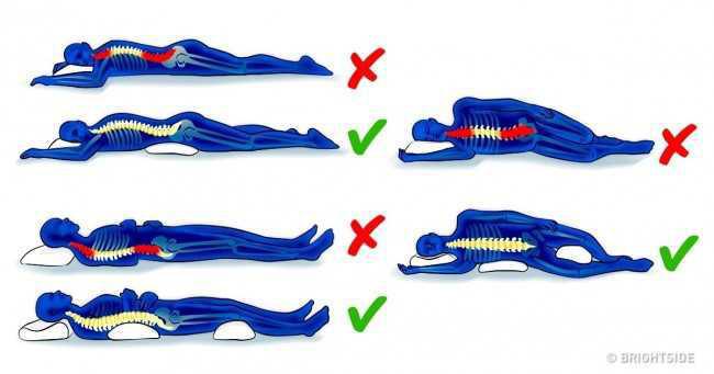 CÓMO CUIDAR NUESTRA POSTURA: CONSEJOS