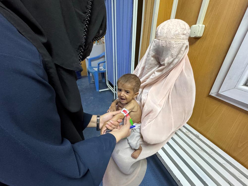 Afghanistan, allarme malnutrizione: +30% di ricoveri tra i bambini più piccoli Afghanistan, allarme malnutrizione: +30% di ricoveri tra i bambini più piccoli