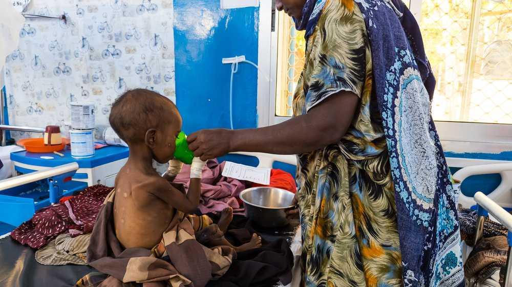 Somalia, a Baidoa un bambino su due soffre di malnutrizione acuta