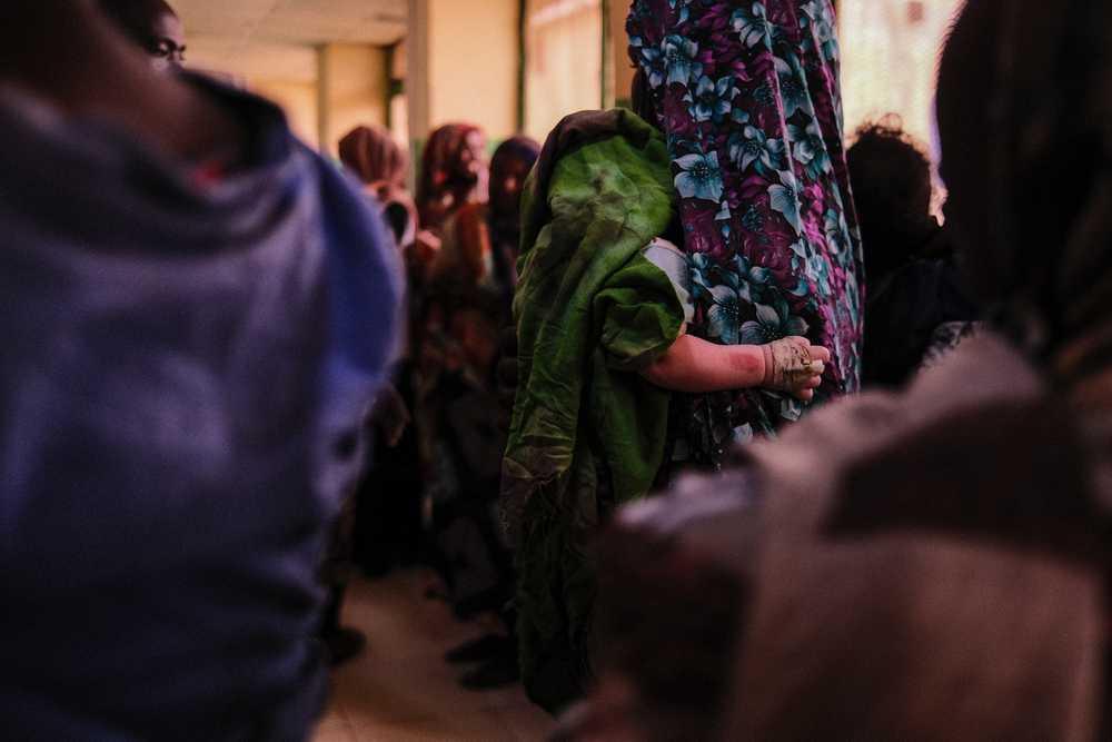 Sudan, i tagli agli aiuti svuotano la sanità: milioni di persone rischiano di restare senza cure Sudan, i tagli agli aiuti svuotano la sanità: milioni di persone rischiano di restare senza cure