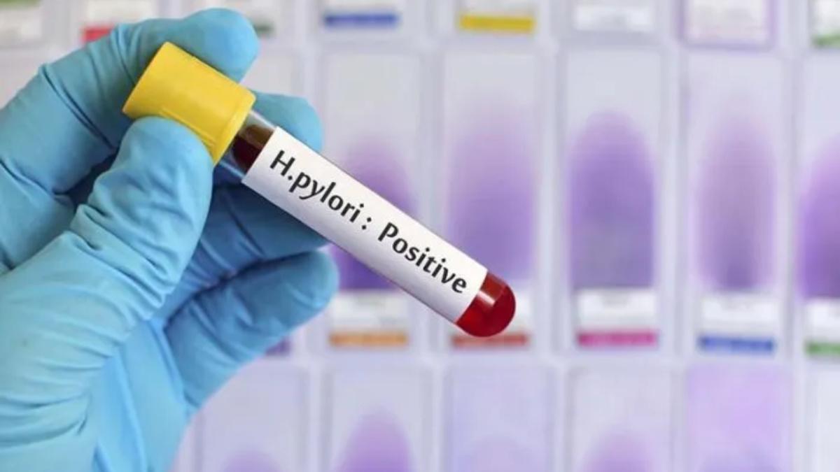 Esame Helicobacter pylori
