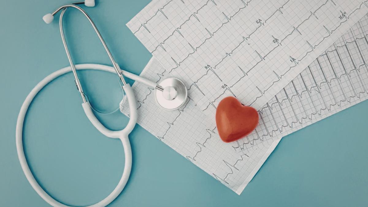 ECG